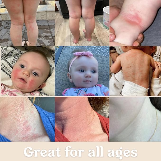 Baby Cream & Baby Serum Power Pair Biome Barrier | For All Skin & Ages | Hydrating Body, Face, Dry Irritated Skin Toddlers, Newborns Skincare (Power Pair)